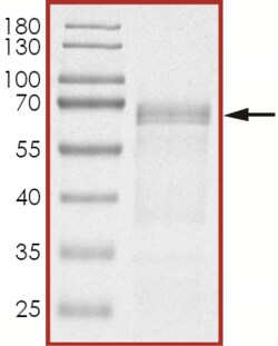 Sino Biological&nbsp;Recombinant Human Tau Protein (Tau-441), DYRK1A-phosphorylated & Biotinylated